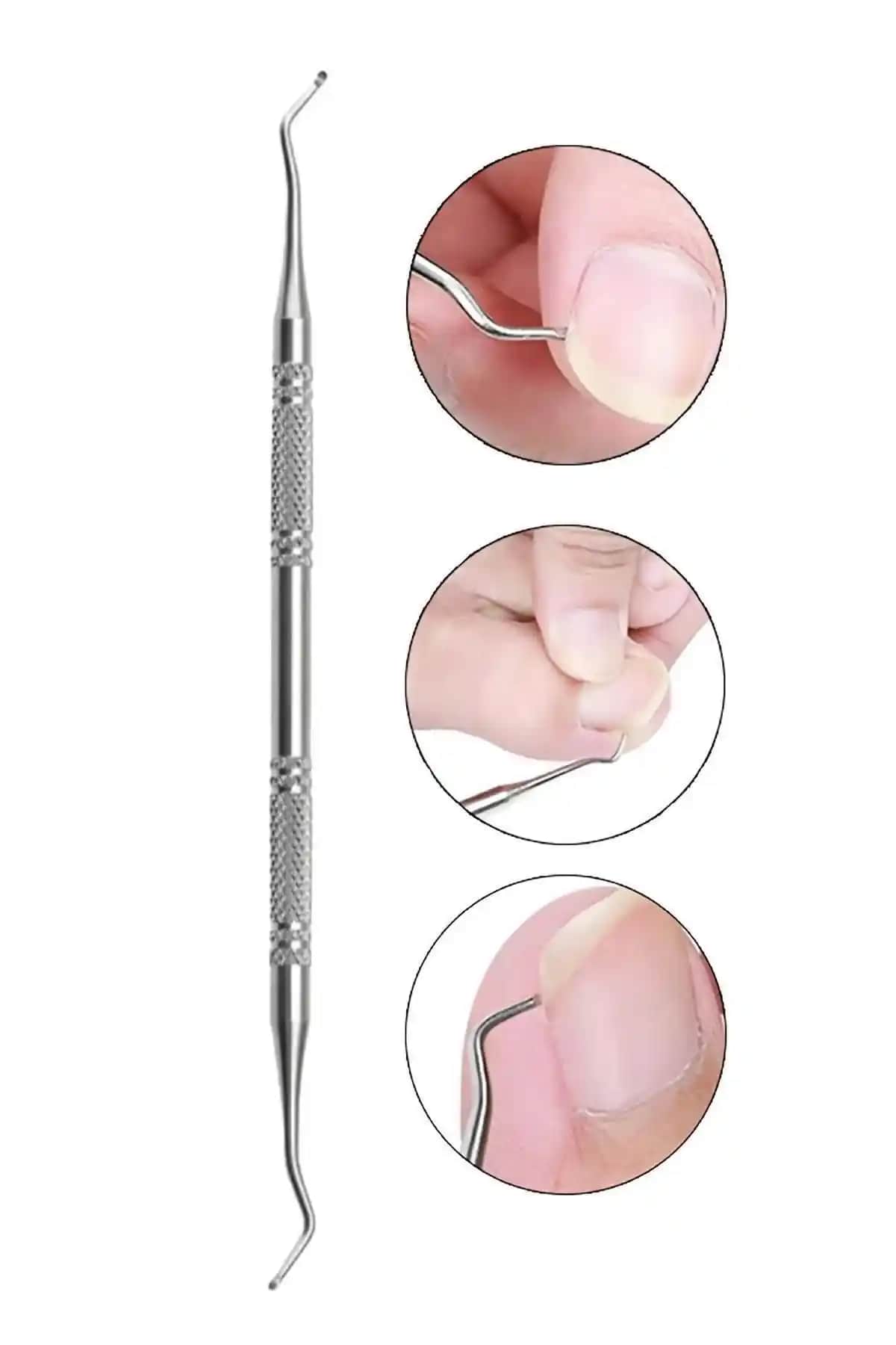 MOZIUR Küret Tırnak Batık Çıkarıcı ile Güvenli ve Etkili Tırnak Bakımı Çözümü