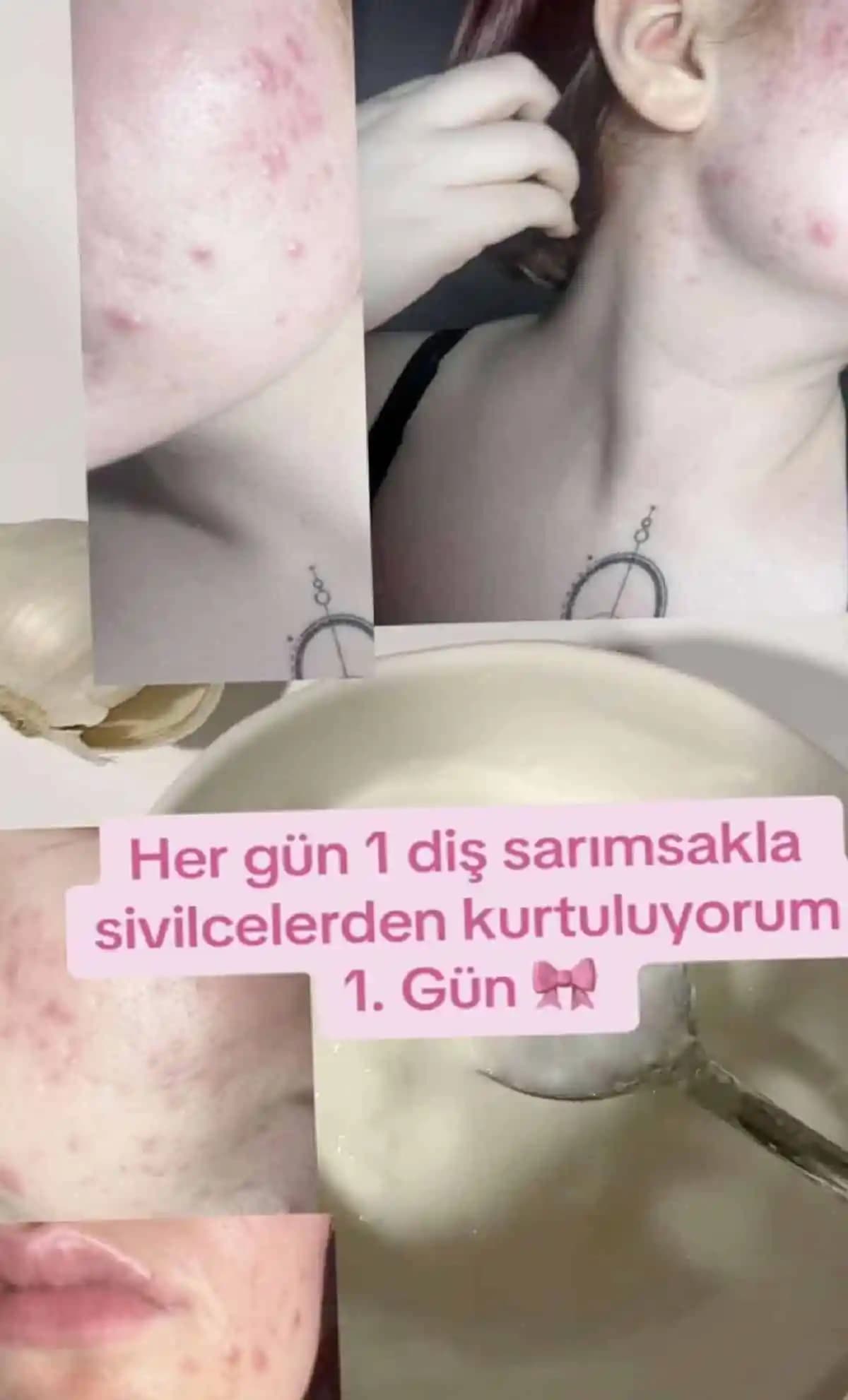 2026 Yılında Sona Ermesi Gereken Cilt Bakımı Trendleri ve Bilimsel Yaklaşımlar