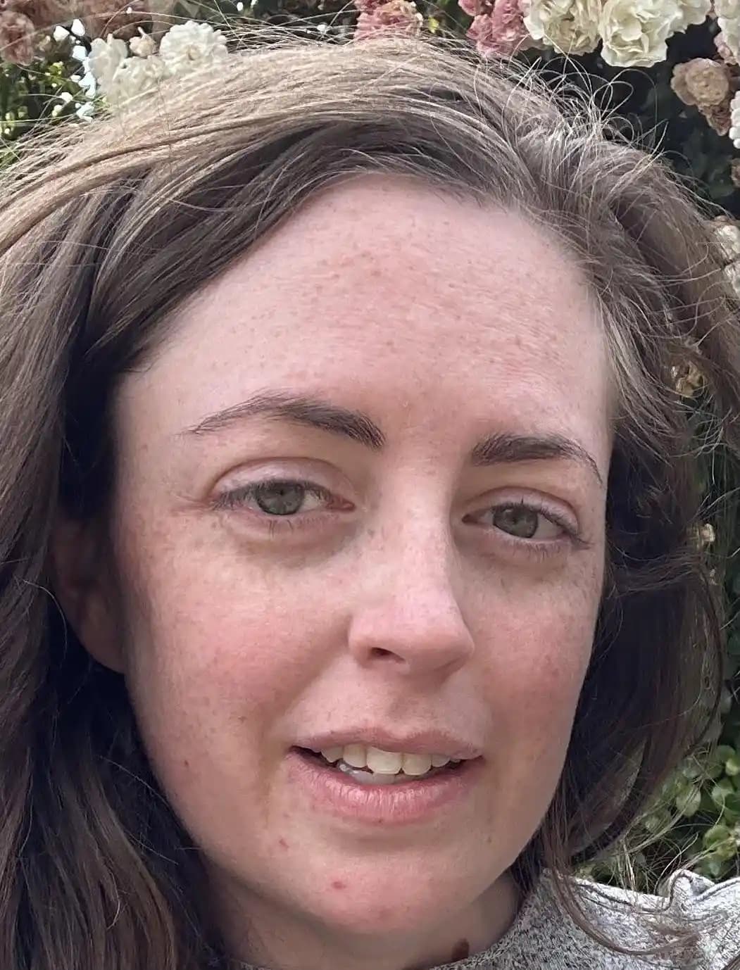 Doğum Sonrası Cilt Bakımı: Nemlendirme, Ton Eşitleme ve Emzirme Dönemi Önerileri