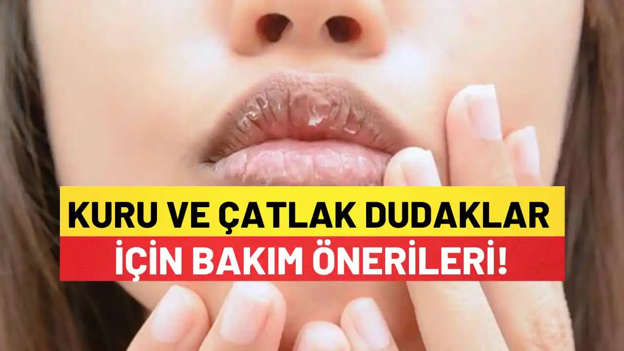 Gece Boyu Dudak Maskeleri: Kuru ve Çatlak Dudaklar İçin Etkili Nemlendirme Yöntemleri