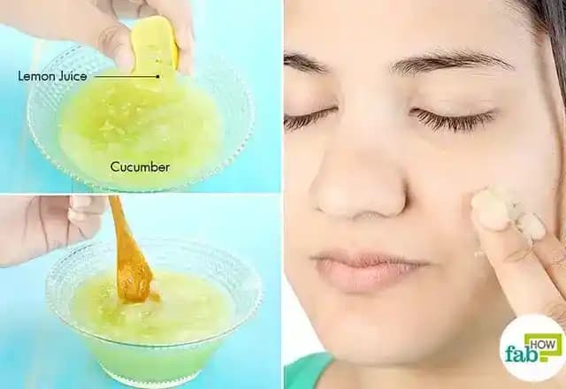 13 Yaşında Sivilce Nasıl Geçer? Evde Etkili ve Doğal Bakım Yöntemleri