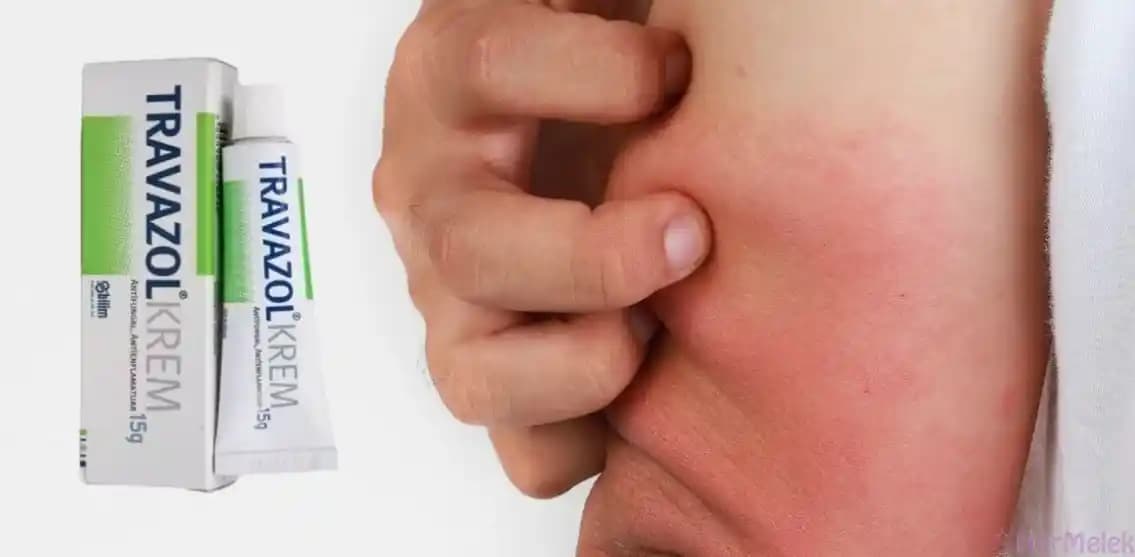 Alerjik Ciltler İçin Etkili ve Hipoalerjenik Krem Seçimi Rehberi