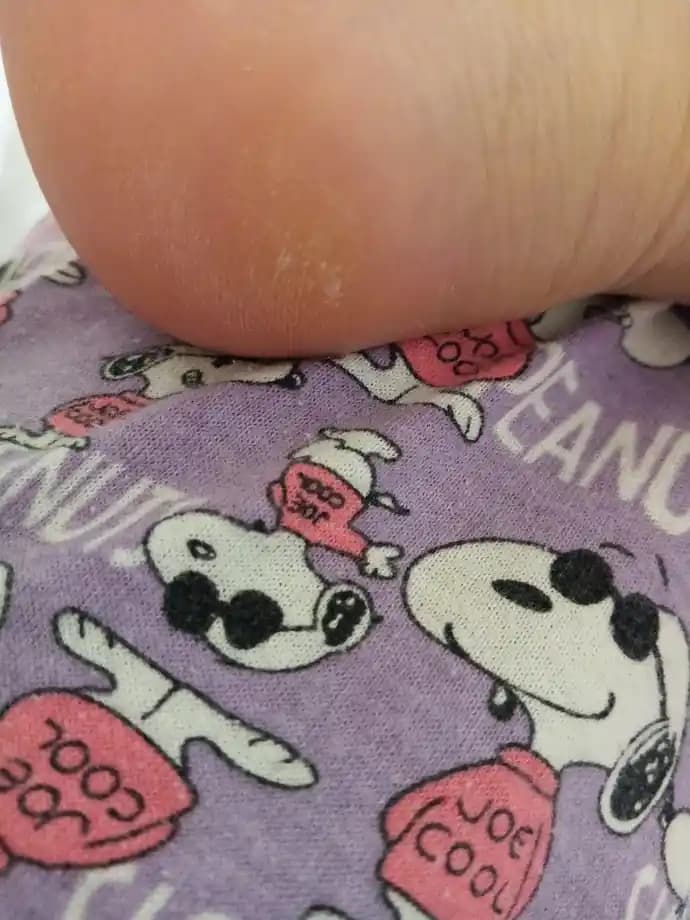 Ayağa Vazelin Sürüp Çorap Giymenin Faydaları ve Doğru Ayak Bakımı Yöntemleri