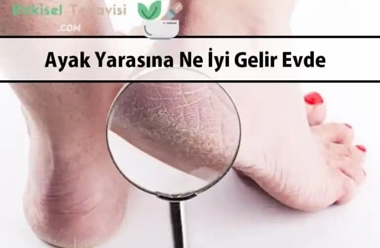 Ayak Altı Yaralarına Etkili Çözümler ve Doğru Bakım Yöntemleri ile İyileşme Süreci