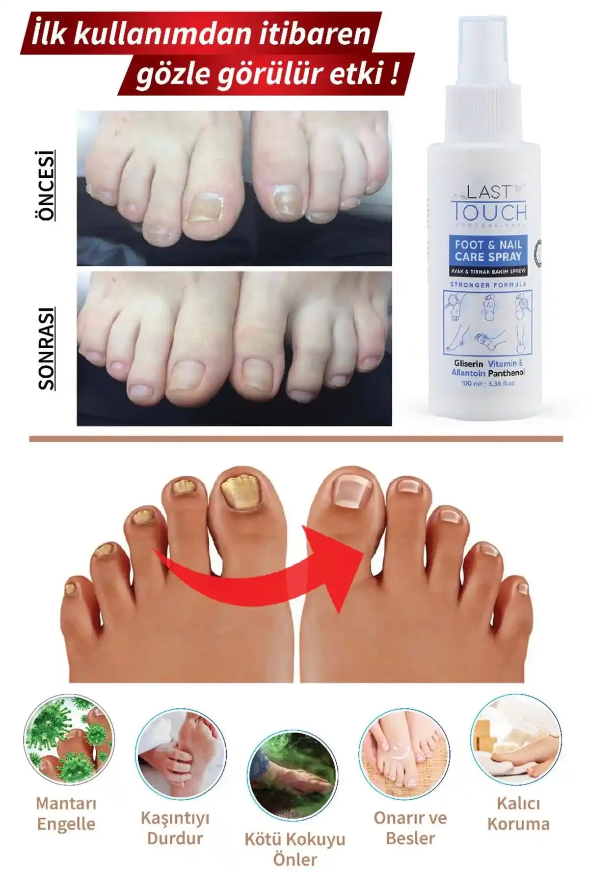 Ayak Mantarı İçin Etkili Krem İsimleri ve Doğru Kullanım Rehberi