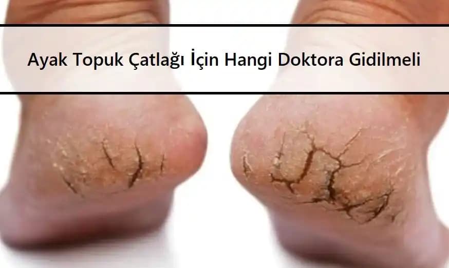 Ayak Topuğu Çatlakları: Nedenleri, Belirtileri ve Etkili Bakım Yöntemleri