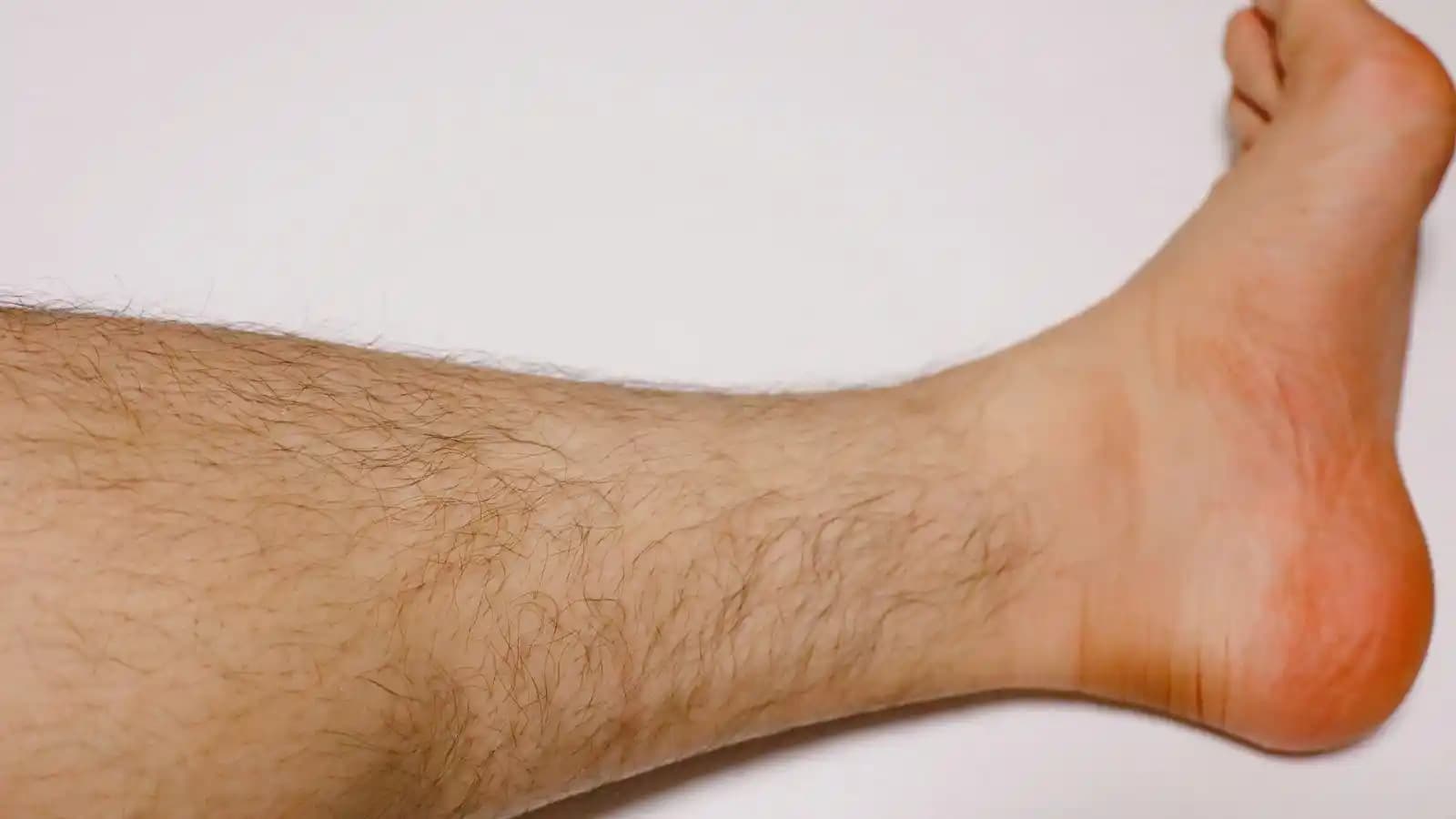 Bacakta Kıl Dökülmesi Nedenleri, Etkileri ve Önleme Yöntemleri Hakkında Detaylı Bilgi