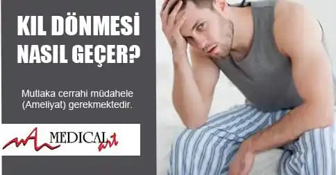 Bacakta Kil Dönmesi Nedenleri, Belirtileri ve Etkili Tedavi Yöntemleri