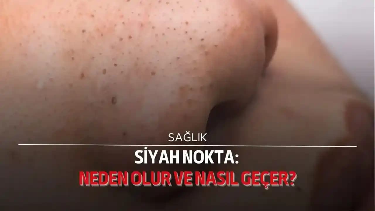 Bebeklerde Siyah Noktaların Nedenleri, Önlenmesi ve Doğru Cilt Bakımı Rehberi