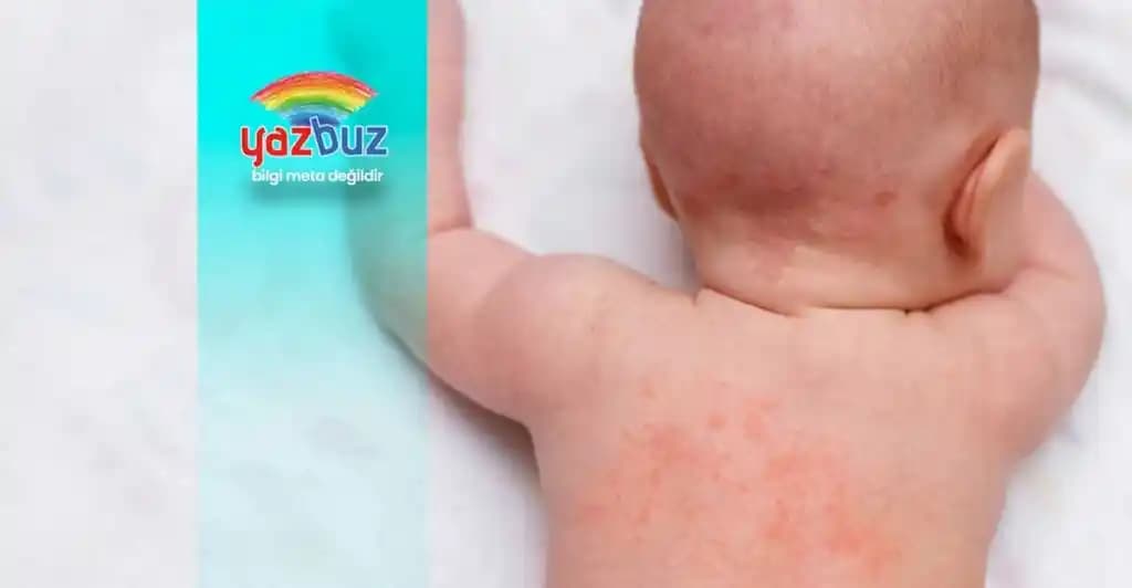 Bebeklerde Yüzde Kırmızı Lekeler: Nedenleri, Belirtileri ve Bakım Önerileri