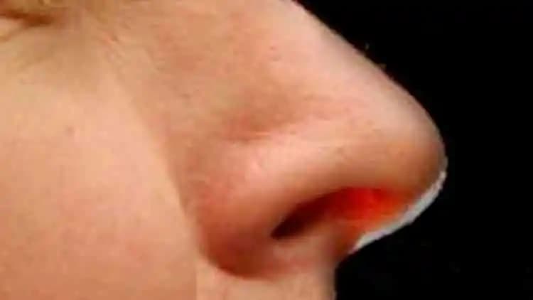 Burnun İçi Kuruluğu: Nedenleri, Belirtileri ve Etkili Bakım Önerileri