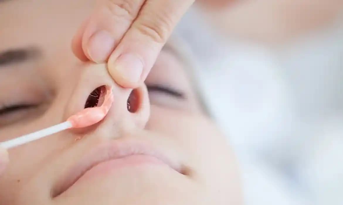 Burun Üstünde Yara: Nedenleri, Tedavisi ve Etkili Bakım Yöntemleri Rehberi