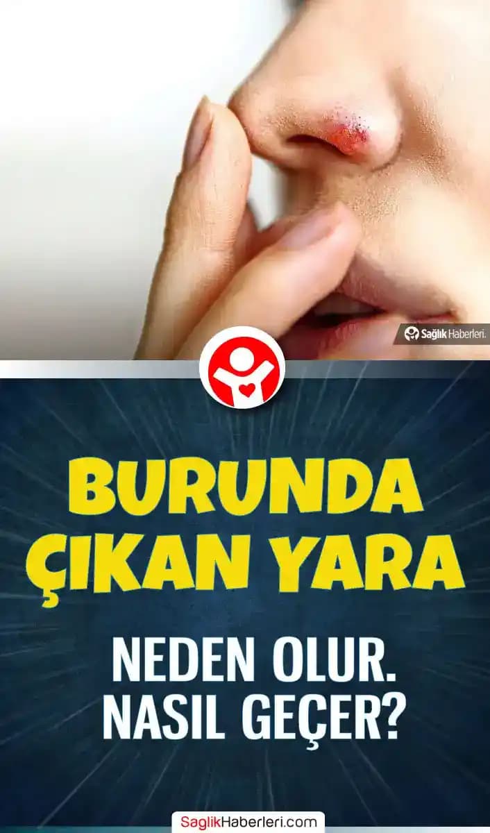 Burun Üstündeki Yara Nasıl Geçer? Etkili Bakım ve Tedavi Yöntemleri Rehberi