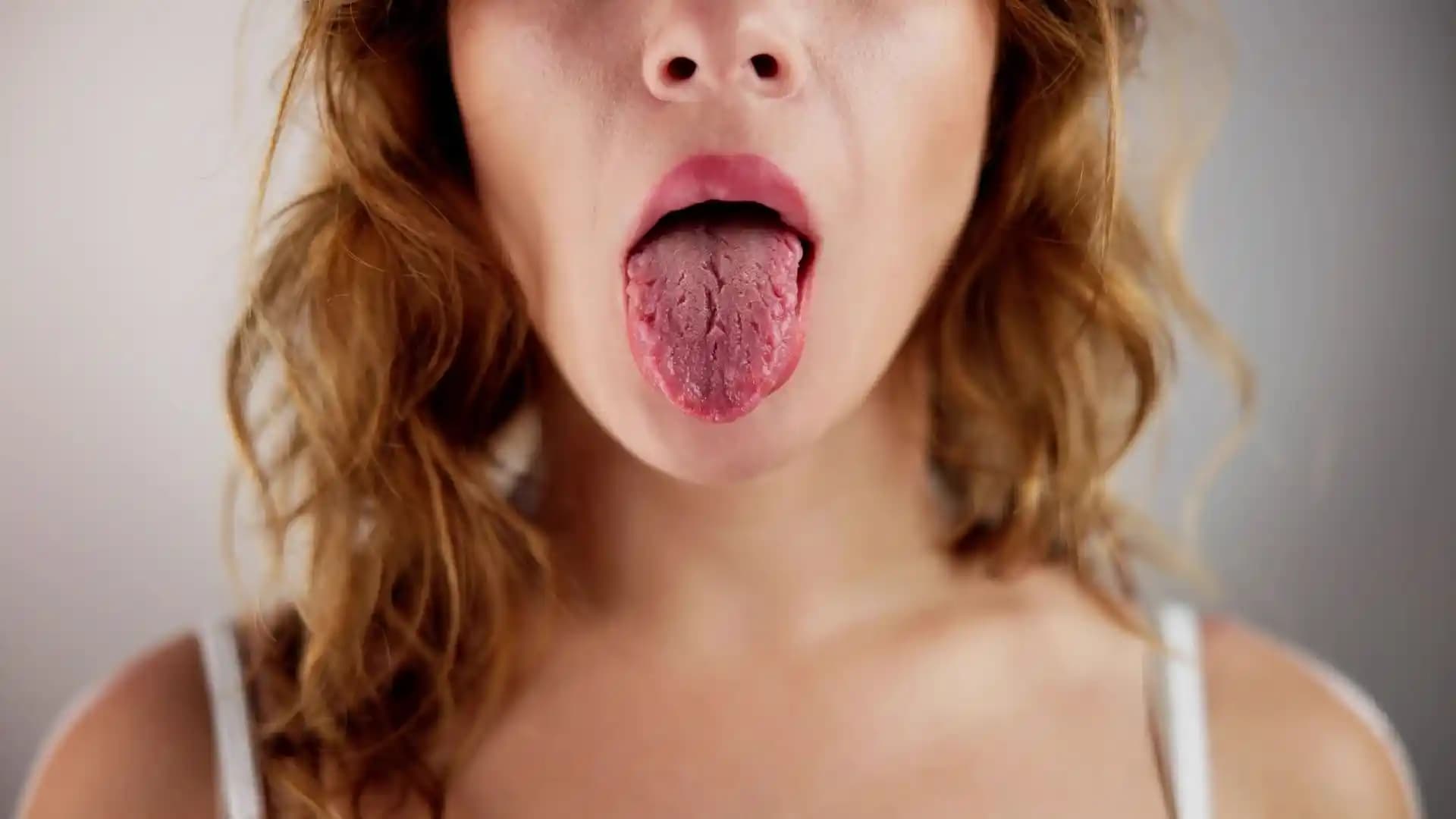 Çatlak Dil Nedenleri ve Bakımı: Sağlıklı Dil ve Ağız Sağlığı Rehberi