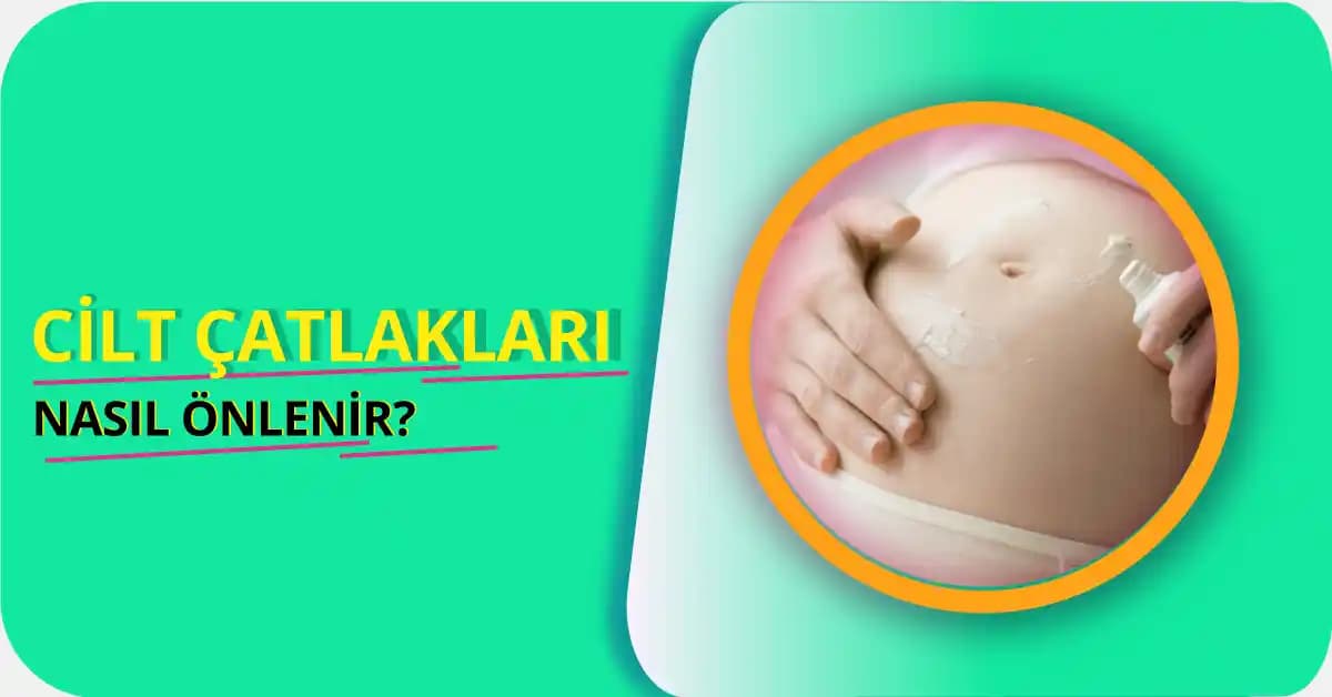 Cilt Çatlakları Nasıl Önlenir? Etkili Yöntemler ve Tedavi Seçenekleri