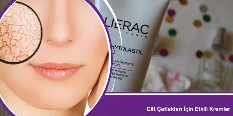 Cilt Çatlaklarını Önlemek İçin Etkili Yöntemler ve Bakım Önerileri