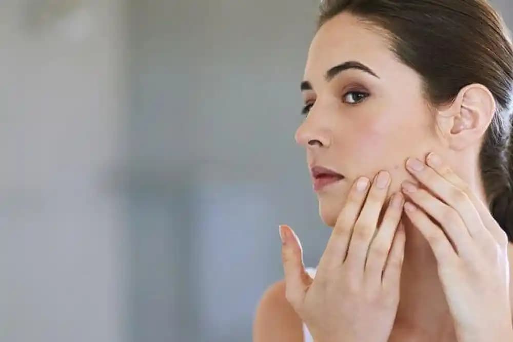 Çinko ve Sivilce İlişkisi: Cilt Sağlığında Doğru Kullanımın Önemi ve Yanlış Anlamalar