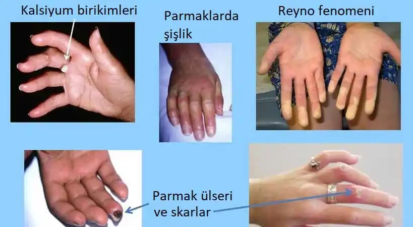 Derma Nedir? Cilt Bakımında Derma Katmanının Önemi ve Uygulamaları