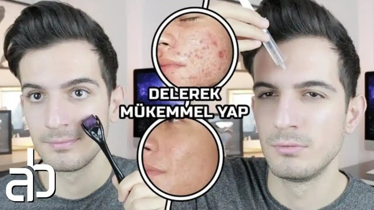 Dermaroller Kullanımı ve Öncesi Sonrası Etkileriyle Cilt Bakımında Yenilikler