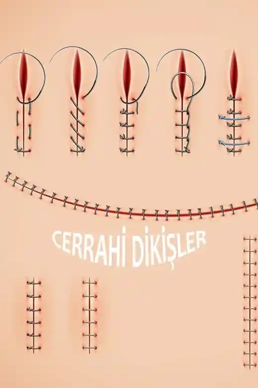 Dikişler Nasıl Alınır? Güvenli ve Doğru Dikiş Alma Rehberi - 2024