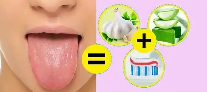 Dil Beyazlaması Nedenleri, Doğal Çözümler ve Ağız Sağlığı İçin Öneriler