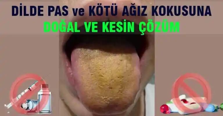 Dilde Pas Nedir? Ağız Sağlığı ve Güzellik İçin Önemi ve Mücadele Yöntemleri