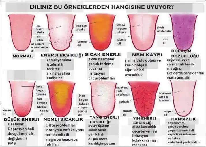 Dilin Beyaz Olması: Nedenleri, Teşhis Yöntemleri ve Etkili Tedavi Seçenekleri