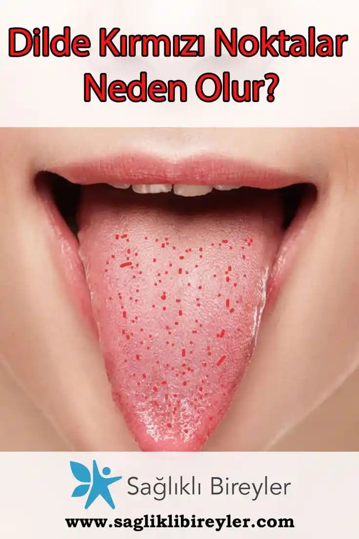 Dilin Üzerindeki Kırmızı Noktaların Nedenleri, Bakımı ve Sağlık Önemi