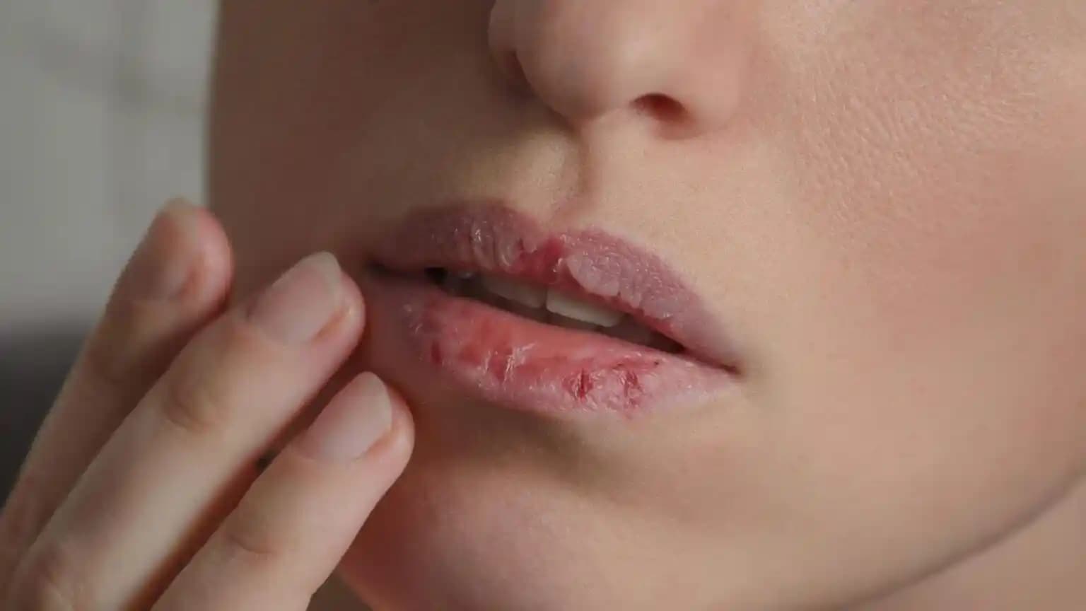 Dudak Çatlaklarına İyi Gelen Kremler ve Etkili Bakım Yöntemleri