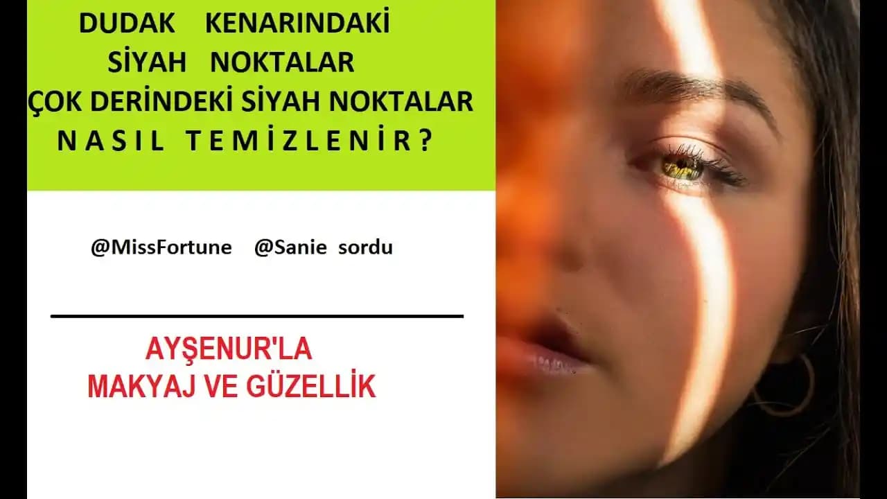 Dudak Kenarındaki Siyah Noktaların Nedenleri, Önlenmesi ve Etkili Tedavi Yöntemleri