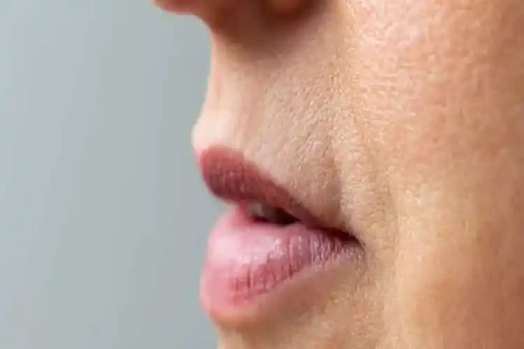 Dudak Siyah Noktaları: Nedenleri, Önleme Yöntemleri ve Etkili Tedavi Seçenekleri