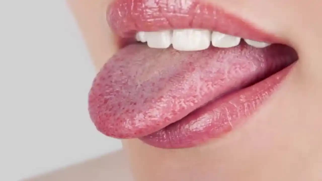 Dudakta Çatlakların Nedenleri, Belirtileri ve Etkili Bakım Önerileri