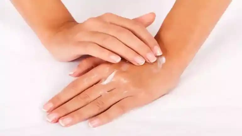 El Çatlakları İçin Etkili Doğal ve Medikal Tedavi Yöntemleri ve Korunma Önerileri