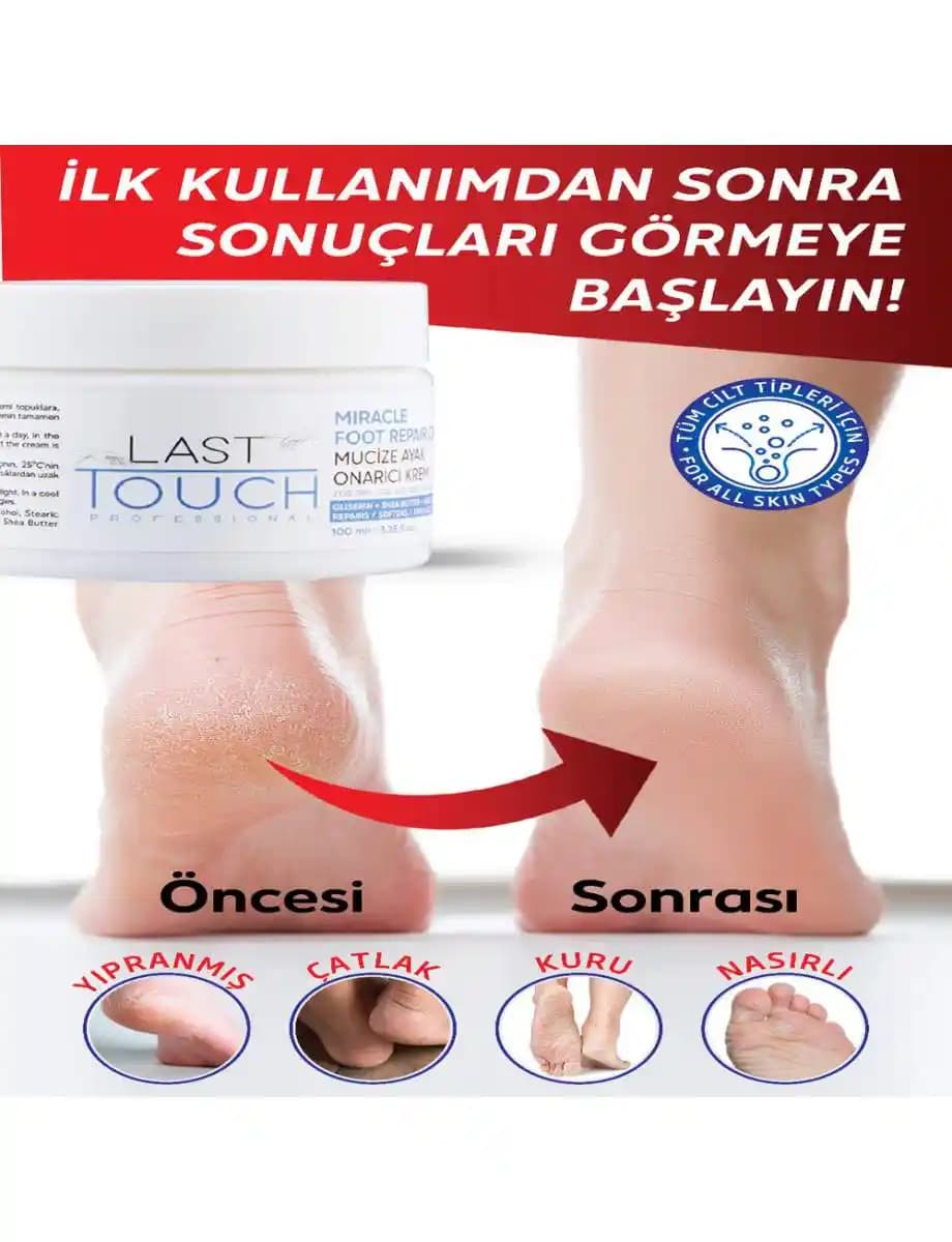 En İyi Ayak Mantar Kremi: Etkili Tedavi ve Doğru Kullanım Rehberi