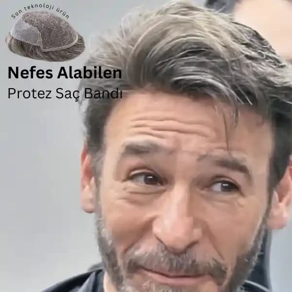 En İyi Protez Saç Bandı Seçimi: Doğal Görünüm, Konfor ve Dayanıklılık Kriterleri