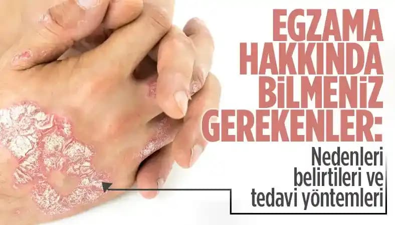 Göğüs Arası Egzama: Nedenleri, Belirtileri ve Etkili Bakım Yöntemleri