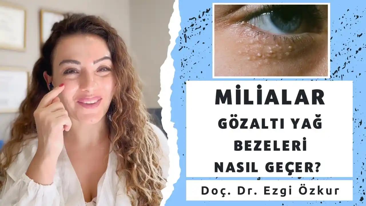 Göz Altı Yağ Bezeleri: Nedenleri, Belirtileri ve Etkili Tedavi Yöntemleri