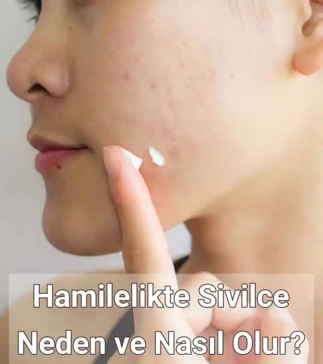 Hamilelikte Sivilce: Nedenleri, Belirtileri ve Güvenli Cilt Bakım Önerileri