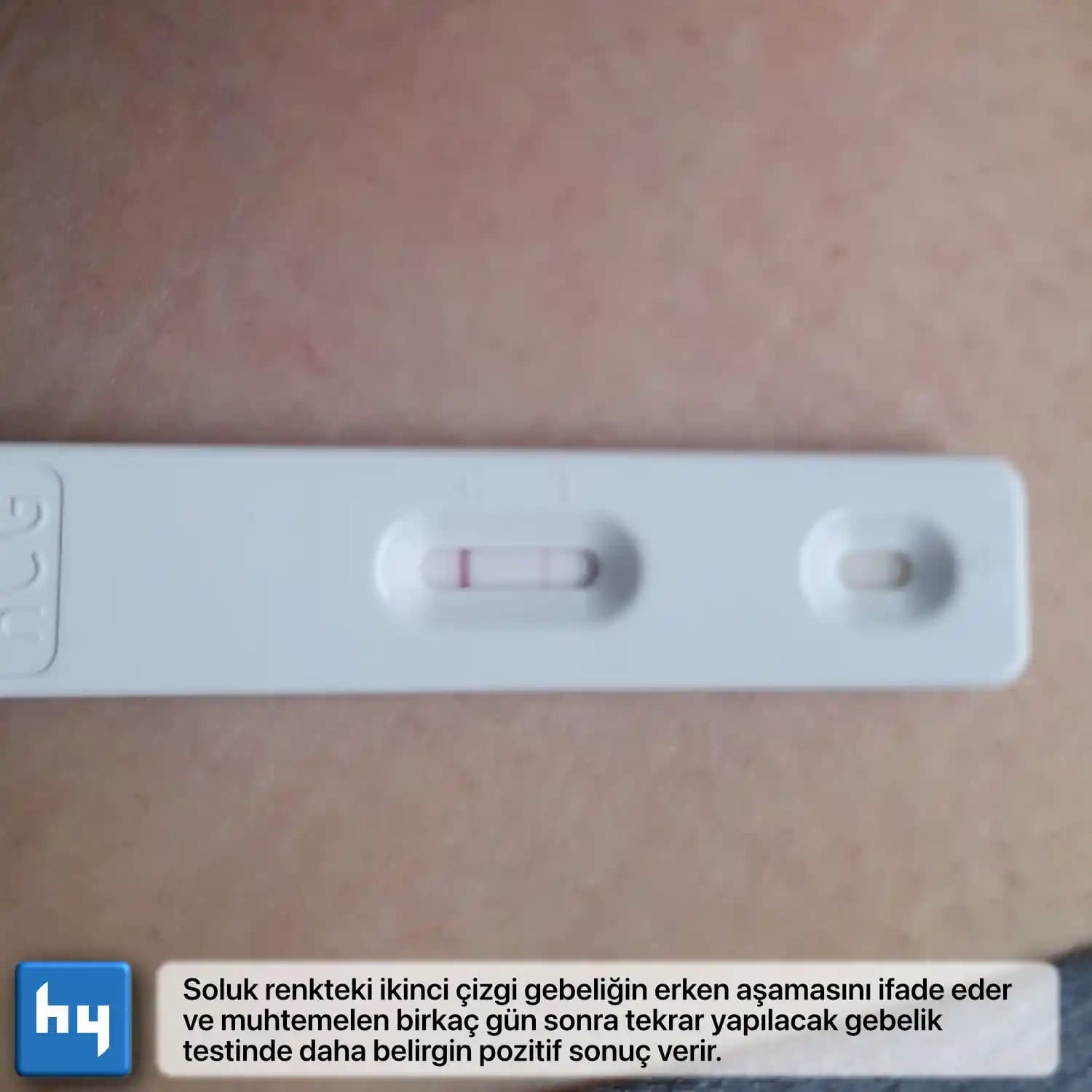 Hangi Gebelik Testi Daha İyi? Doğru Sonuç İçin Bilmeniz Gerekenler