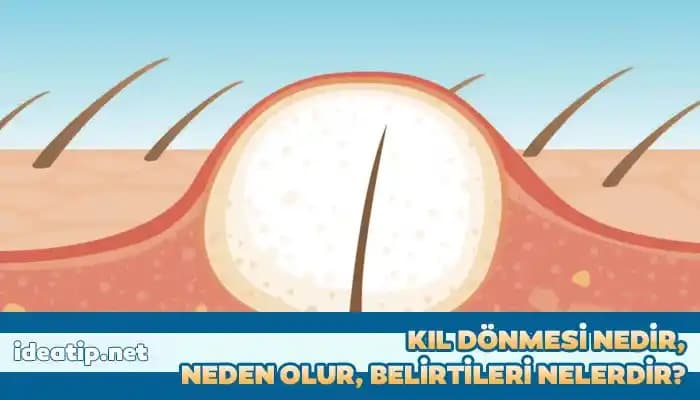 Kıl Dökülmesi Nedenleri, Belirtileri ve Etkili Tedavi Yöntemleri Hakkında Bilgi