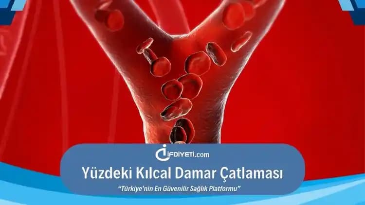 Kılcal Damar Çatlamasına İyi Gelen Etkili Tedavi ve Bakım Yöntemleri
