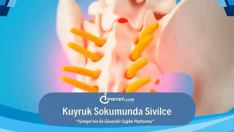 Kuyruk Sokumunda Sivilce Nedenleri, Önleme Yolları ve Etkili Tedavi Yöntemleri