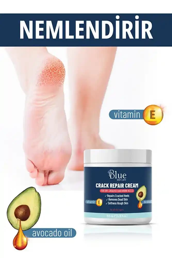 Mantar İçin En Etkili Kremler ve Cilt Sağlığı İçin Doğru Tedavi Yöntemleri