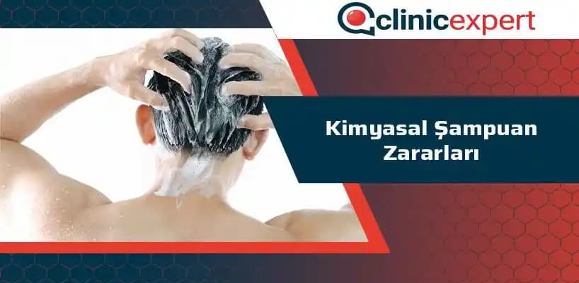 Mirage Şampuan Zararları ve Saç Sağlığına Etkileri: Bilmeniz Gerekenler