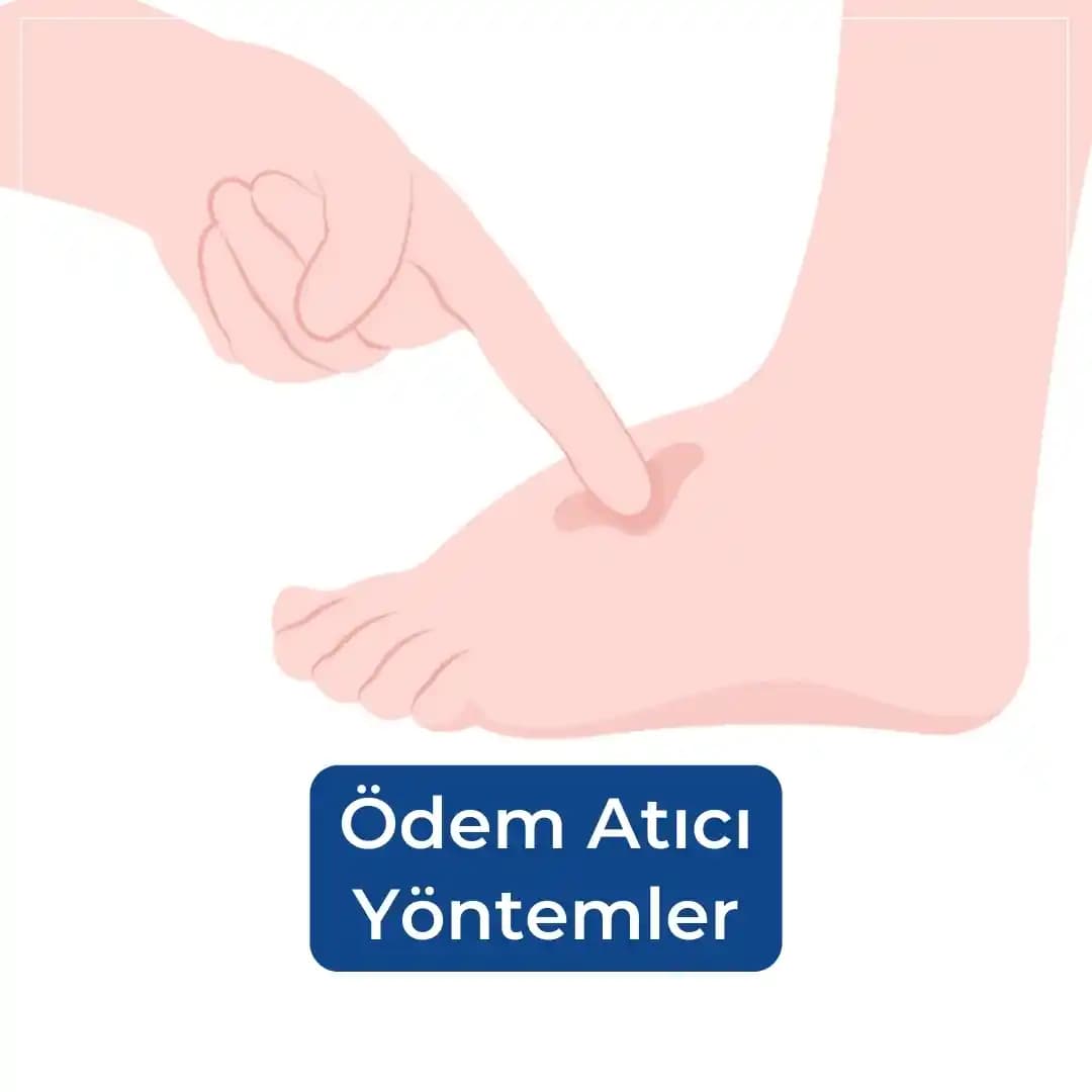 Ödem Atan İlaçlar ve Doğal Yöntemlerle Vücut Şişliklerini Etkili Şekilde Azaltma