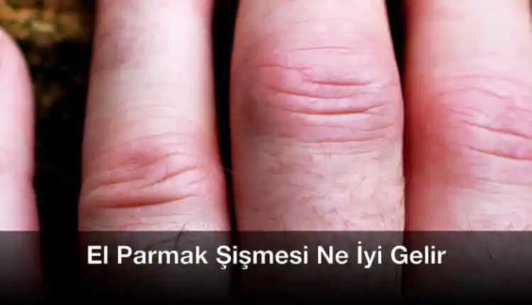 Parmak Çatlamasına Ne İyi Gelir? Doğal ve Kozmetik Etkili Çözümler Rehberi