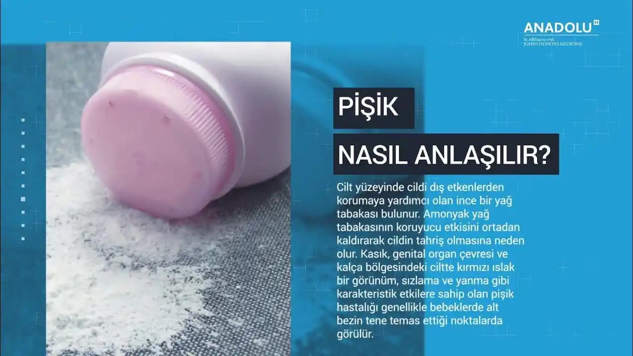 Pişik Nedir, Belirtileri ve En Kolay Geçiren Etkili Doğal Yöntemler