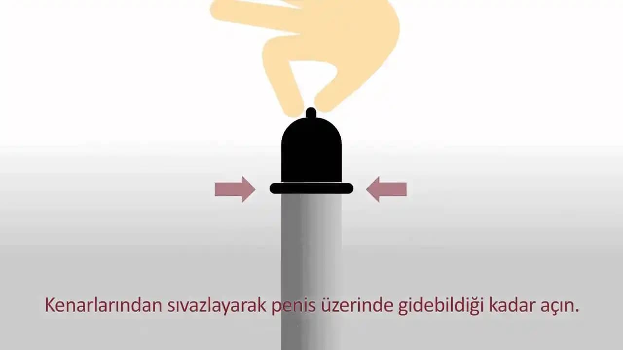 Prezervatif Nasıl Takılmalı: Doğru Kullanım ve Güvenli Korunma Rehberi