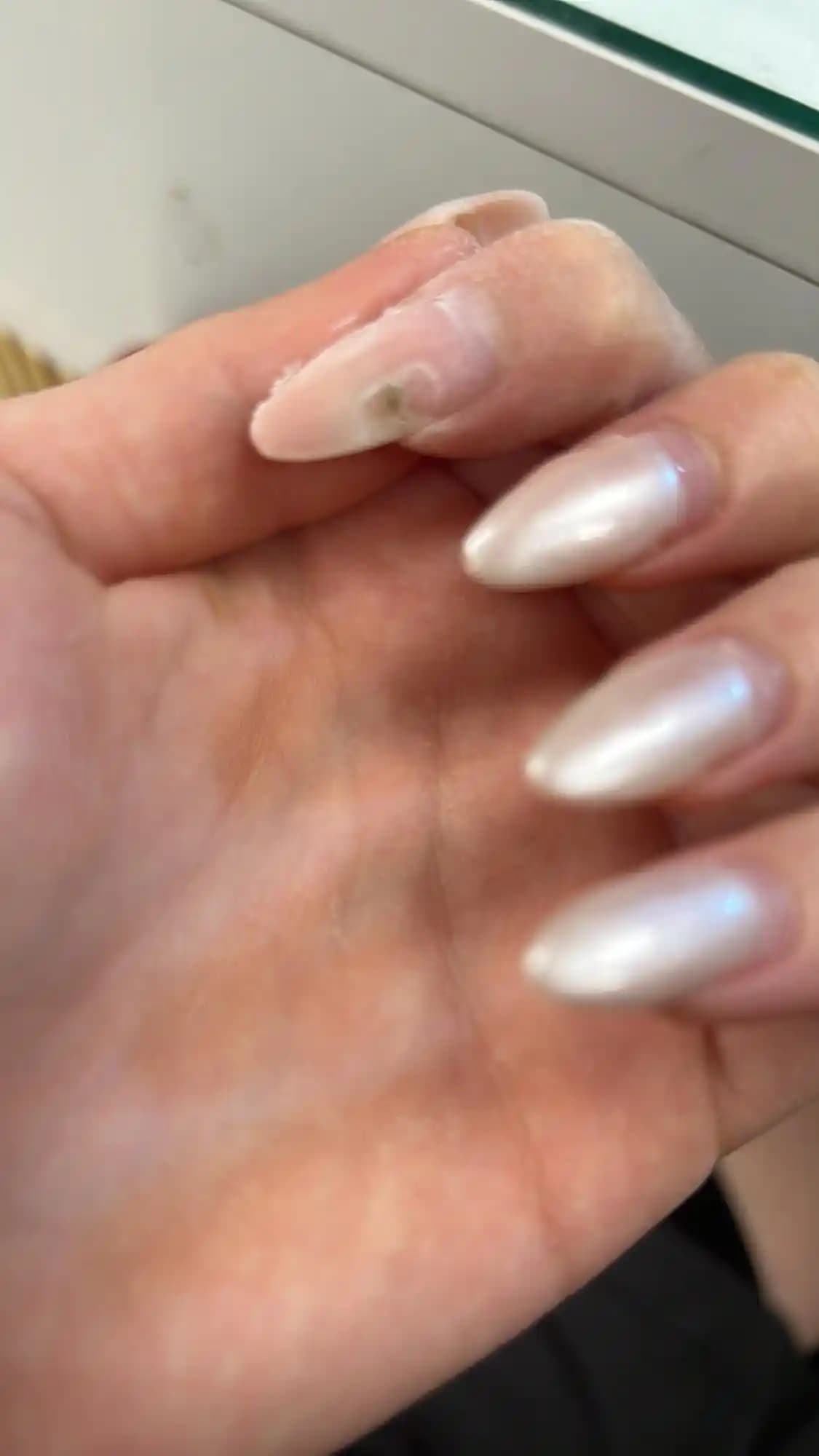 Protez Tırnaklarda Hava Alması: Nedenleri, Önemi ve Etkili Çözüm Yöntemleri