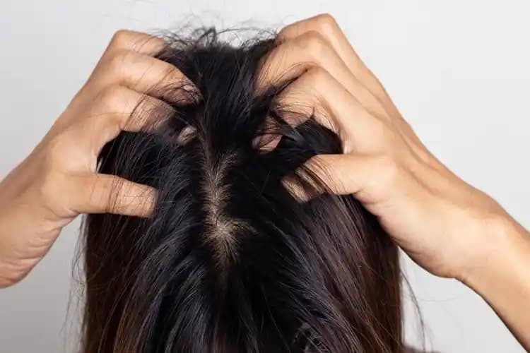 Saç Dibi Kaşıntısının Nedenleri ve Saç Derisi Sağlığını Korumaya Yönelik Çözümler